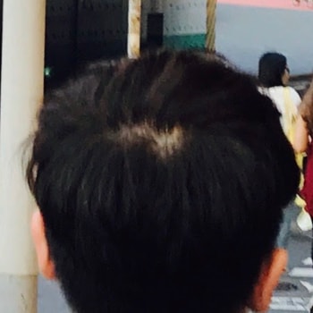 2017