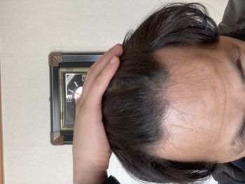 오늘 캡쳐 사진