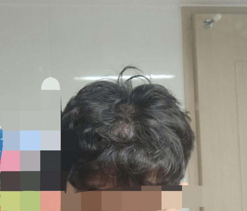 위쪽 머리가 며칠 사이에 횅하게 비어보이는 느낌입니다.