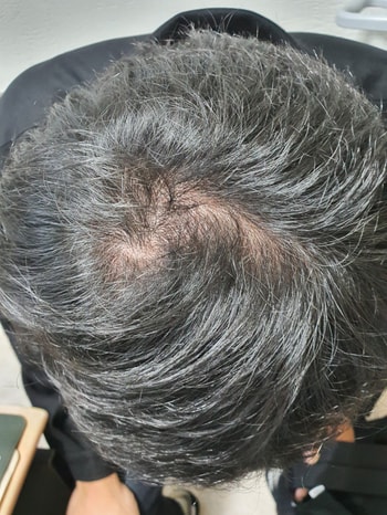 약먹기 전 사진
