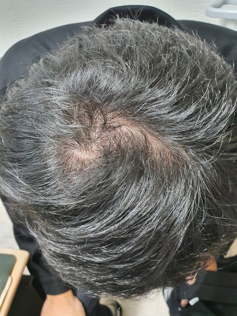 약먹기 전 사진