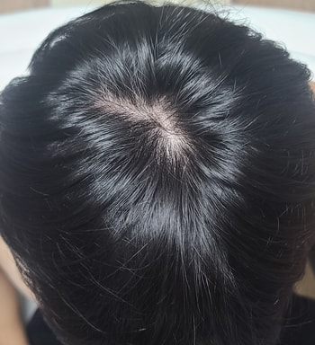 1년뒤 현재사진