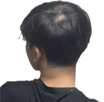 이렇게 뒤에서 보면 알아챌 정도로 파여있네요 ㅠㅠ..
