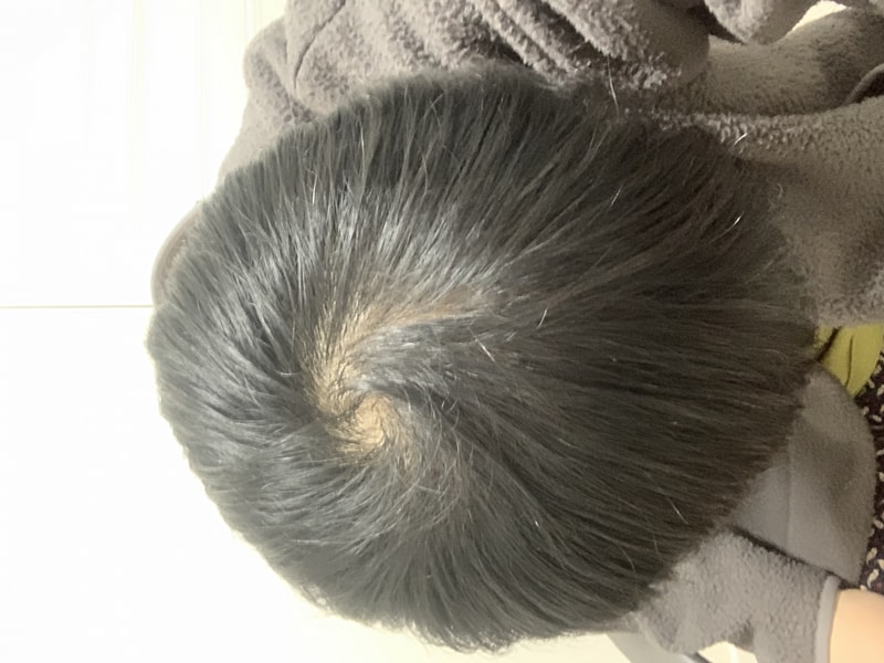 薬の服用7-8ヶ月目はいかがですか？ 再業