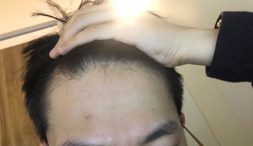 정면