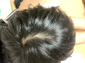 오늘자(조명 아래)
