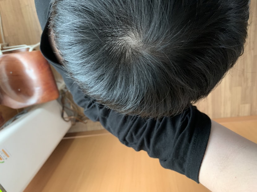 약먹기전