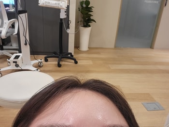치료전 내 머리 ㅎㅎ