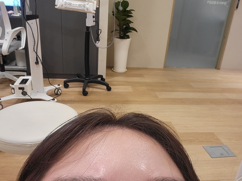 치료전 내 머리 ㅎㅎ