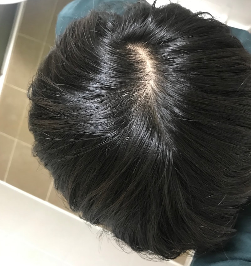 약을 8개월째 먹고있는데, 딱히 체감되는 효과가 없네요