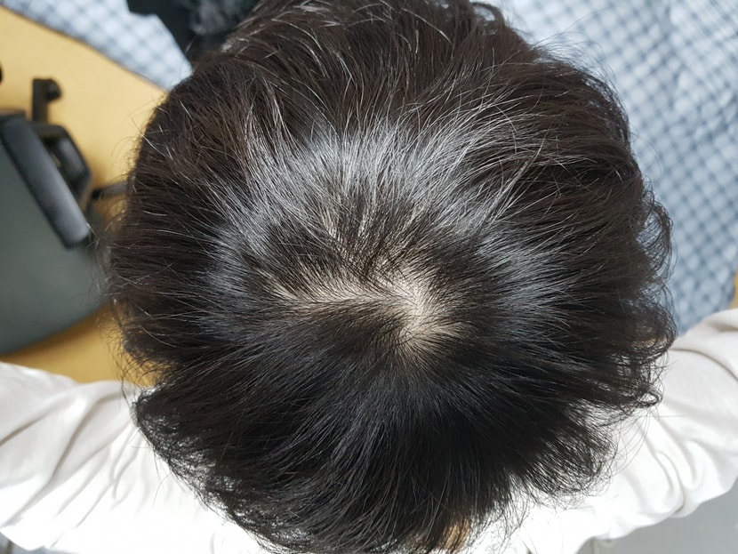 오늘 정수리