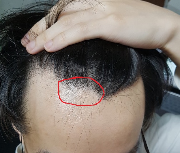 파인부분