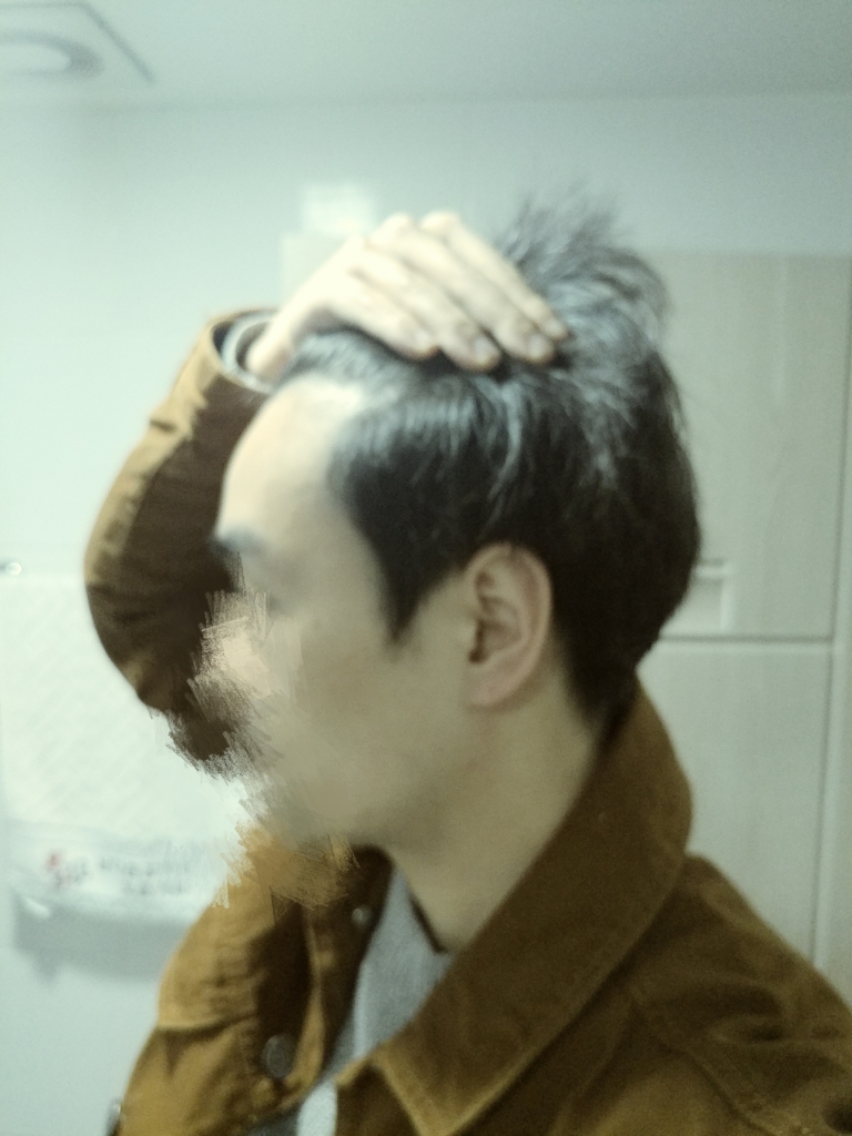 왼쪽