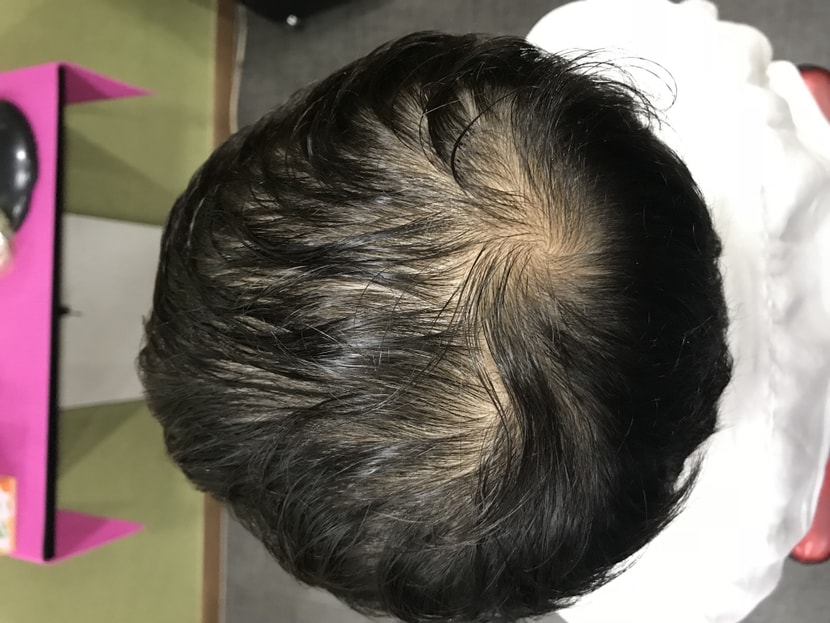 착용전