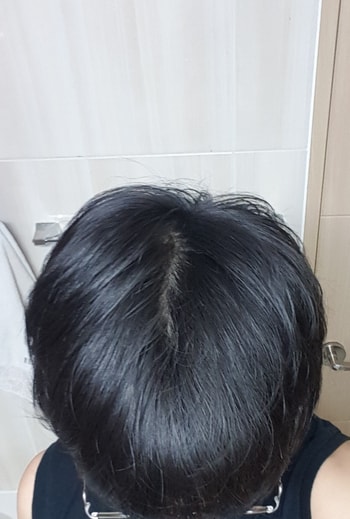 고개를 숙인 뒤 찍은 정수리 3