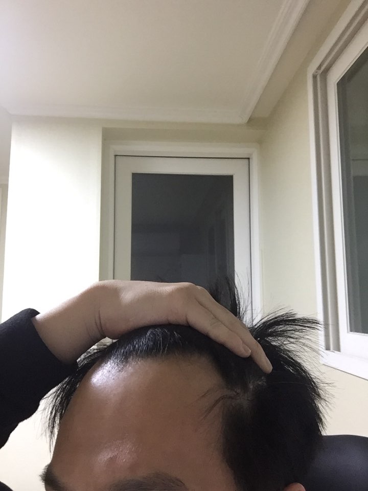 이마