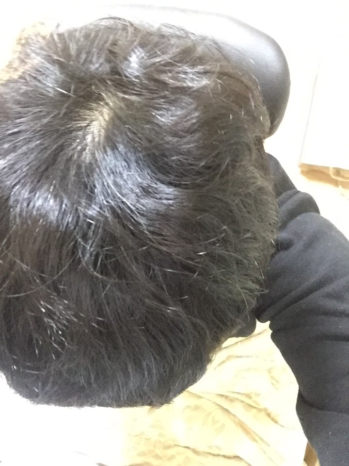 정수리