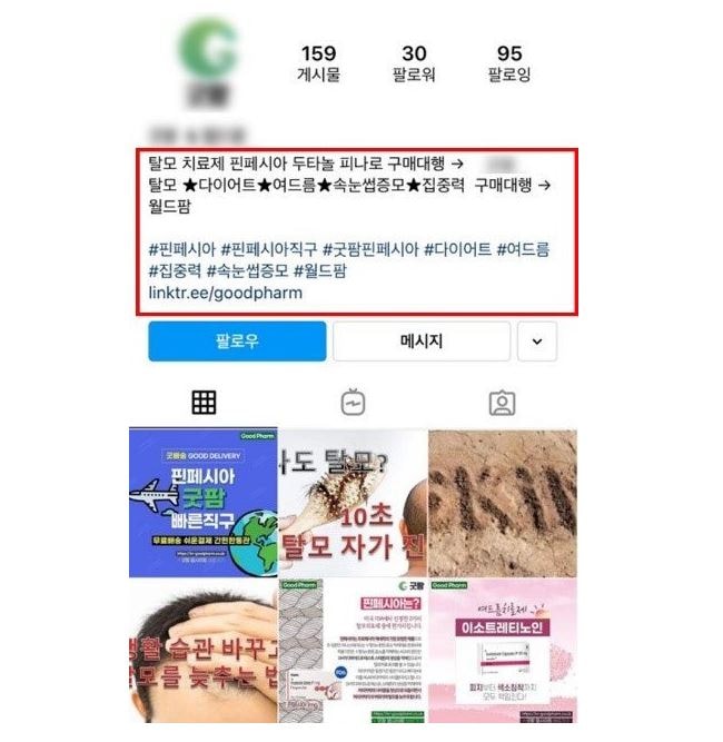 SNS 판매 탈모치료제 불법 '핀페시아' 부작용 위험높아