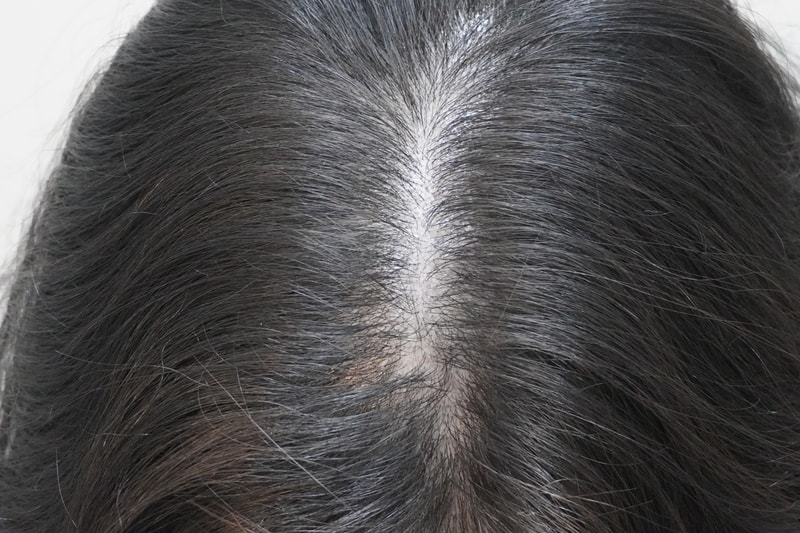 [부산점]뉴헤어모발성형외과