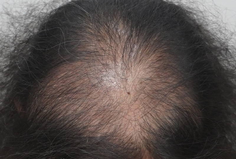 뉴헤어 부산점 8회차 후기입니다 *^^*