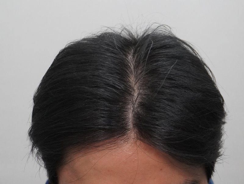 뉴헤어부산 해운대 점 6개월째 치료중