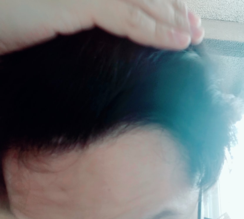 오른쪽 정상부위