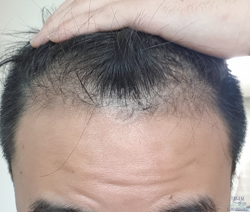 1달 차