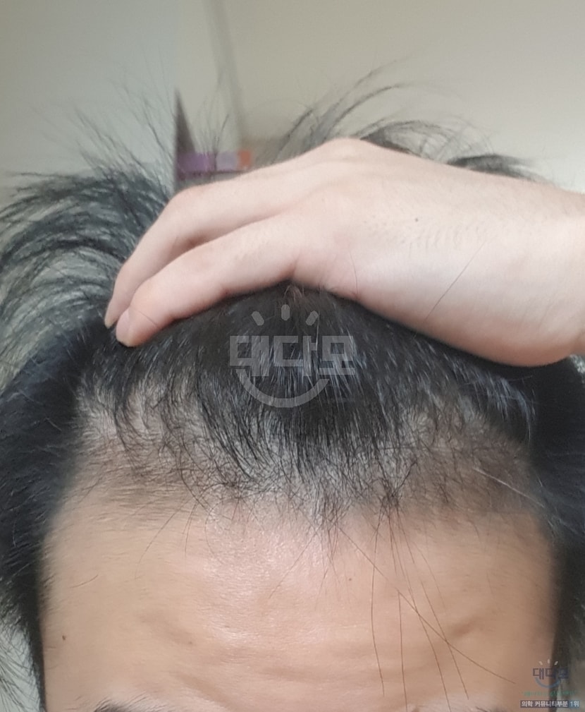 2달 차