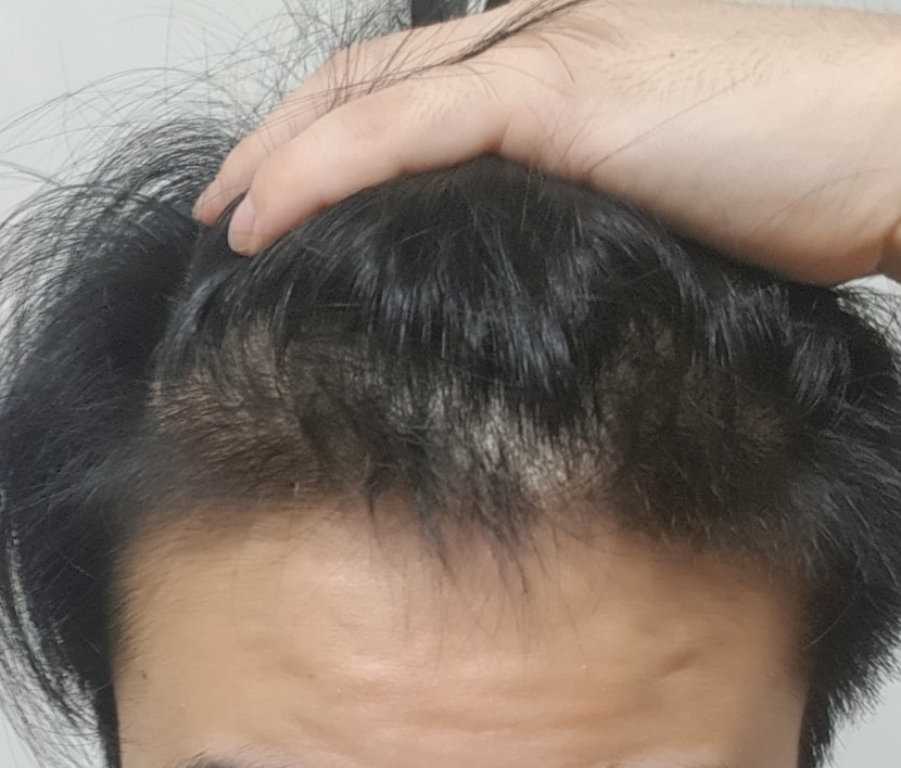 현재