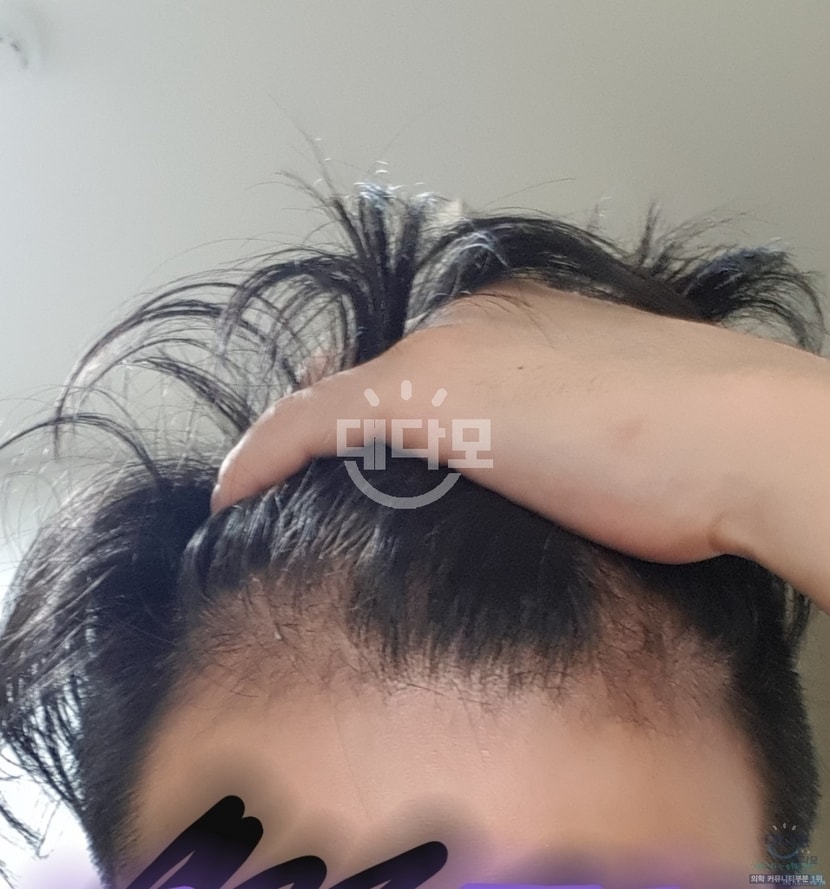 복용 전