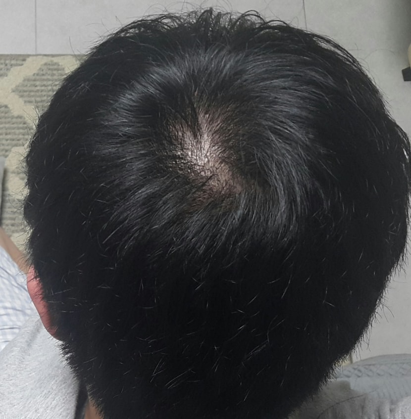 머리 감고 말린 직후