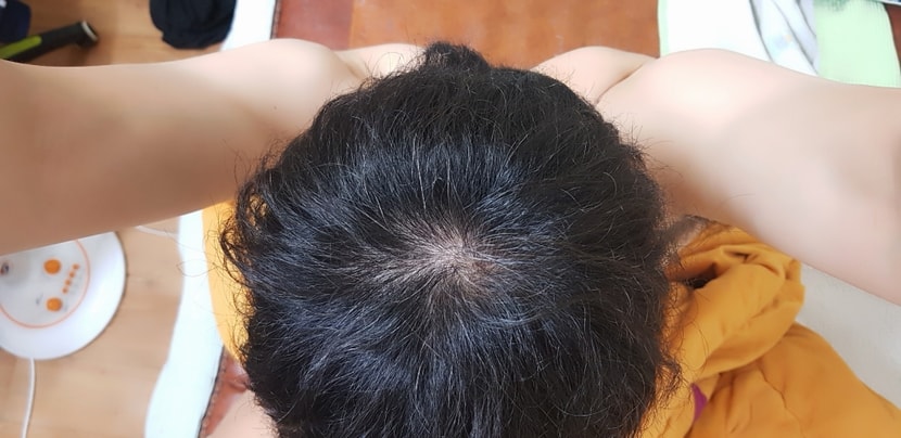 약먹기전