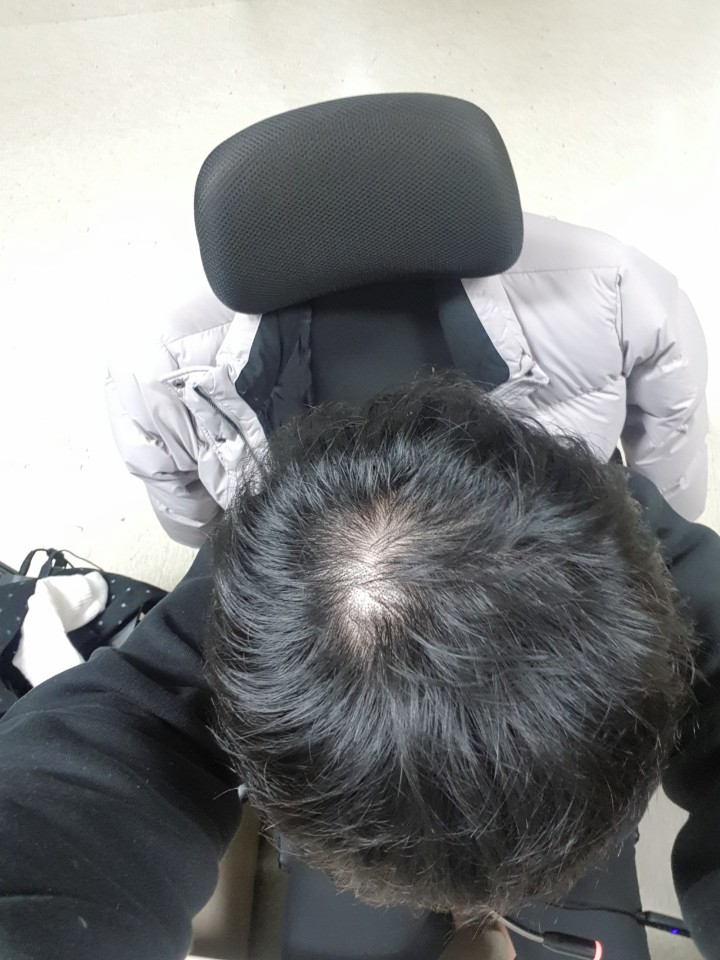 2020년 1월 머리 (조명)