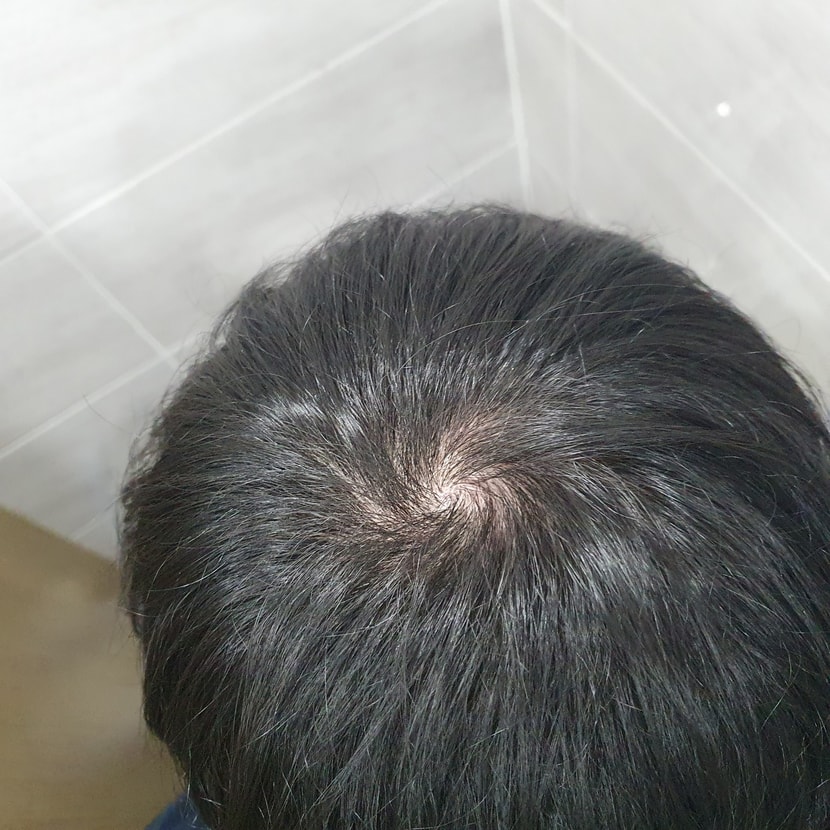 2021년 1월경 찍은 사진