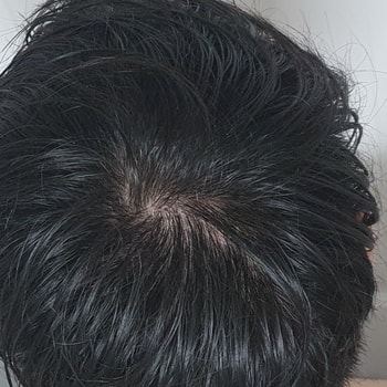 2021년 4월경 머리 감고 말리기전 사진