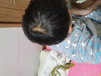 아보다트 8개월