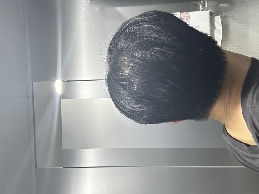 뒤통수