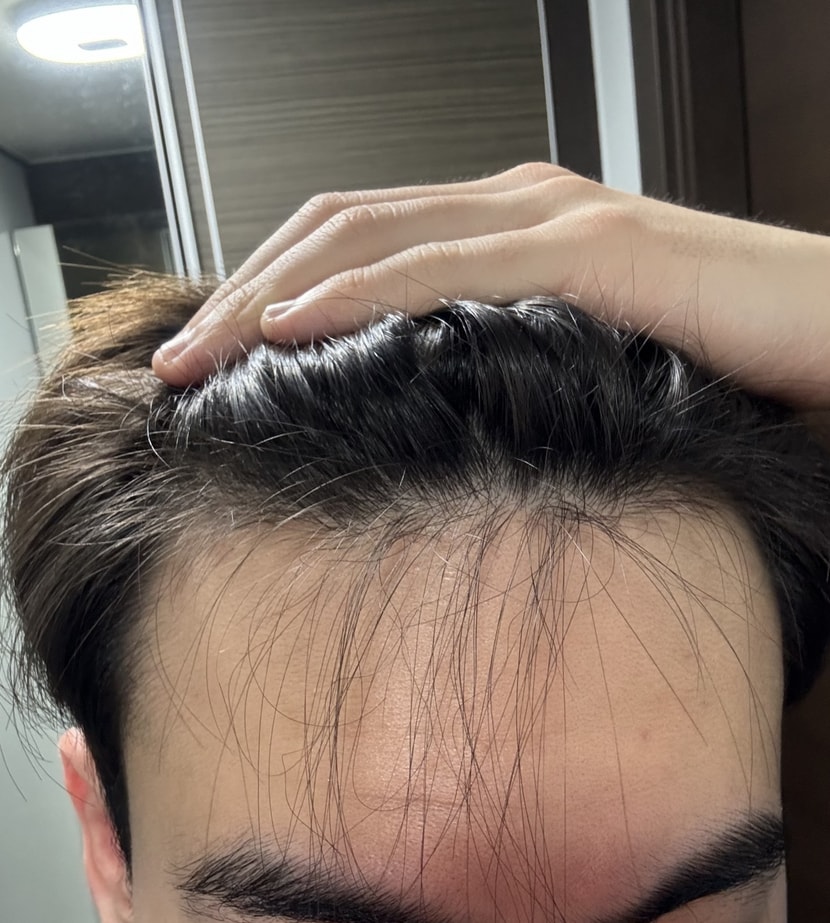 심한 곱슬모들이 보이기 시작
