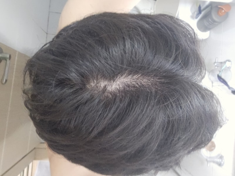 メゾセラピーを受けていたり、受けていたりした後、ホームケアをしている方にお問い合わせいたします···