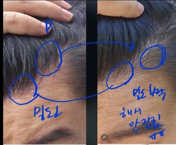 밀도 하락... 파인부분 증가