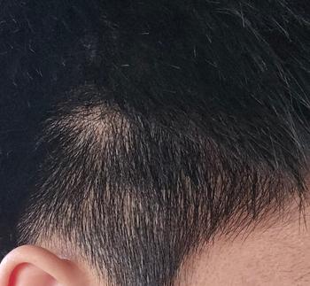 옆머리