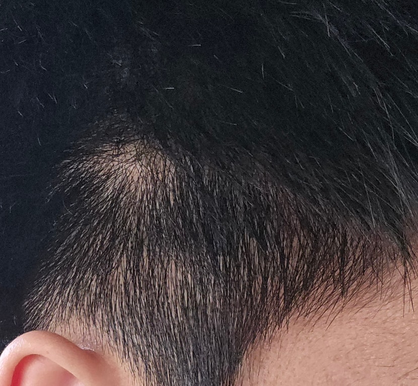 옆머리