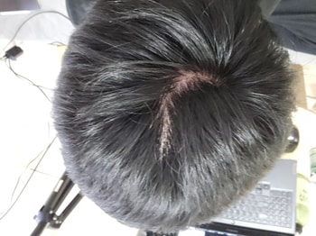 지금