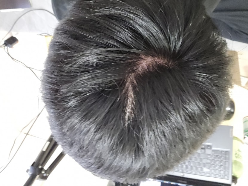 지금