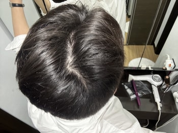뒷머리 갈라보면 보이는 뒷가르마