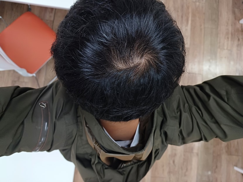 단약 초기