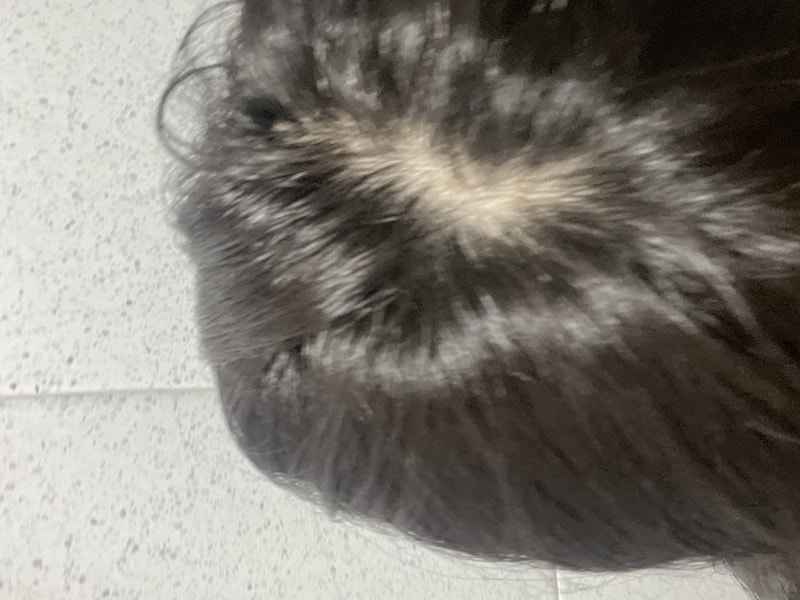 分け目薄毛??
