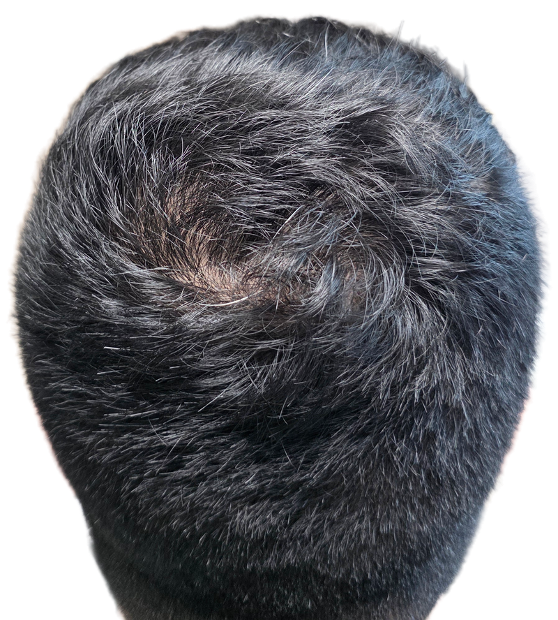 피나 8개월차 이발하고 찍은 사진입니다.