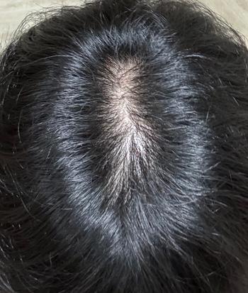 6~7개월 전 사진