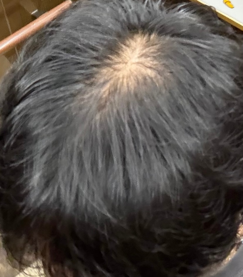 빛